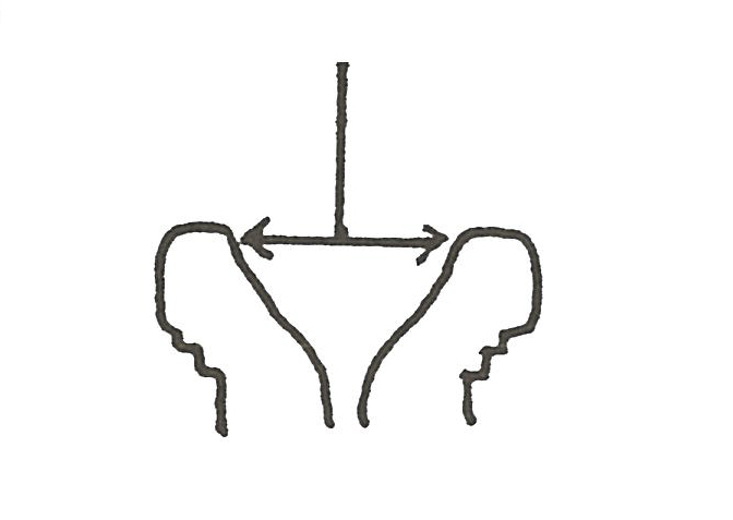 Illustration 1