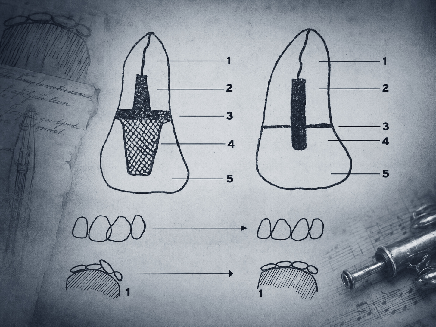 My teeth